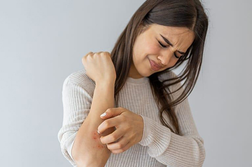 مواد آلرژی زا و ایجاد حساسیت پوستی